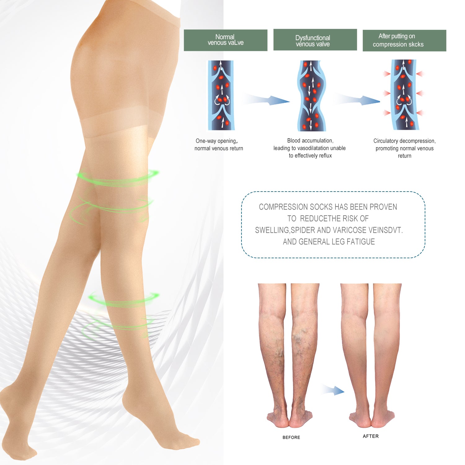Open Toe Medical Compression Socks Graduated 20-30 mmHg