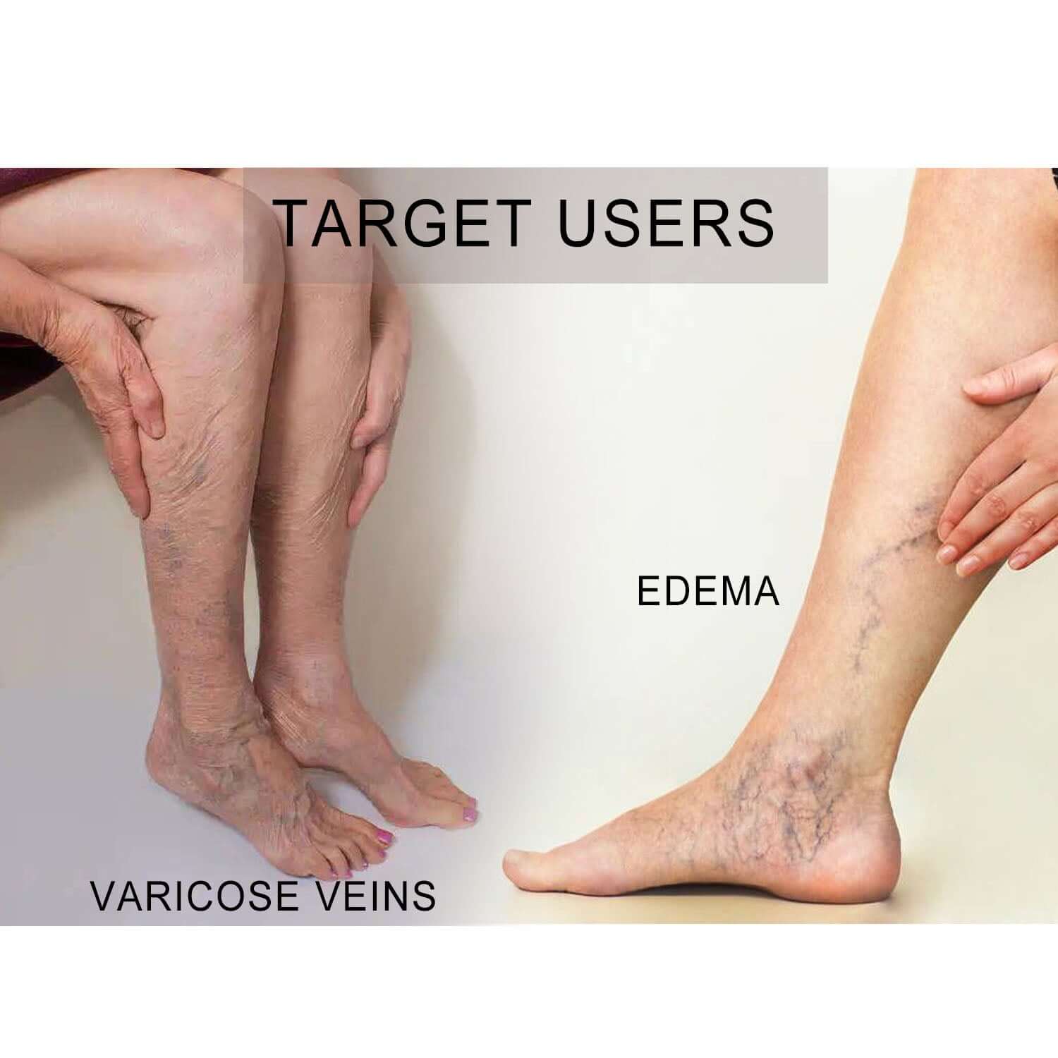 Open Toe Medical Compression Socks Graduated 20-30 mmHg Knee High 1 Pack - md-diab